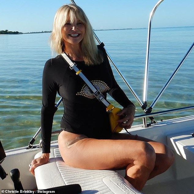 A long comer: She revealed the news on Instagram earlier this month, after a successful procedure, writing, `` I hit my thigh in a ski helicopter crash in the countryside several years ago. ''